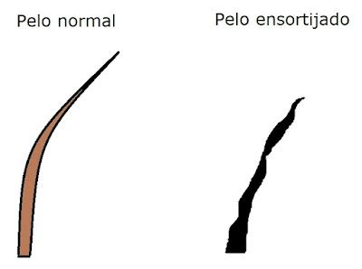 pelo ensortijado causas|Pelo de alambre en hombres: causas, cuidados y tratamientos